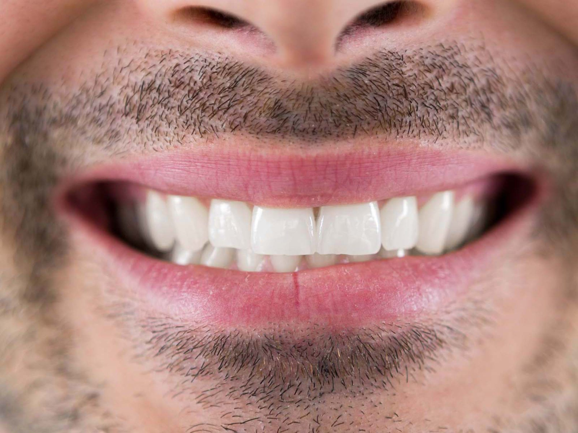 man-showing-his-teeth4-YUFNXWG.jpg